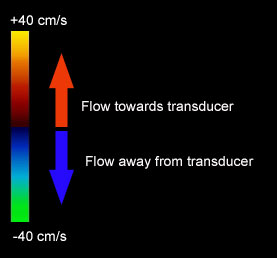 What Do The Colors Mean On Doppler Ultrasound - Infoupdate.org